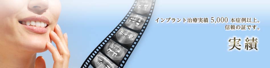 インプラントの実績：5,000本症例以上